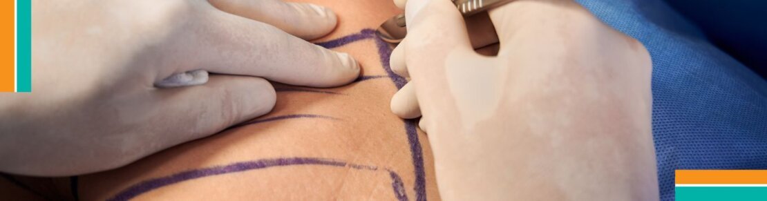 Chiplun plastic surgery